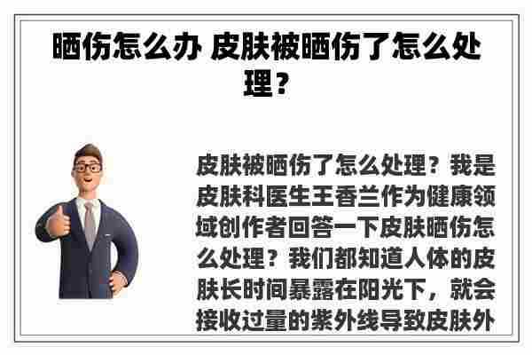 晒伤怎么办 皮肤被晒伤了怎么处理？